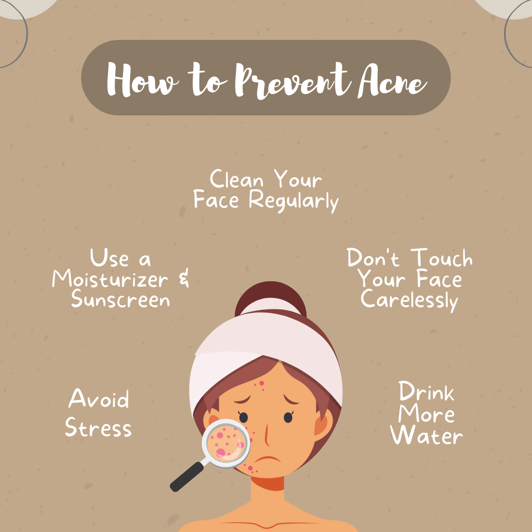 Dry Acne Prone Skincare Routine